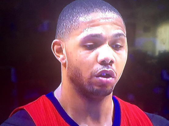 Eric Gordon with his toth missing
